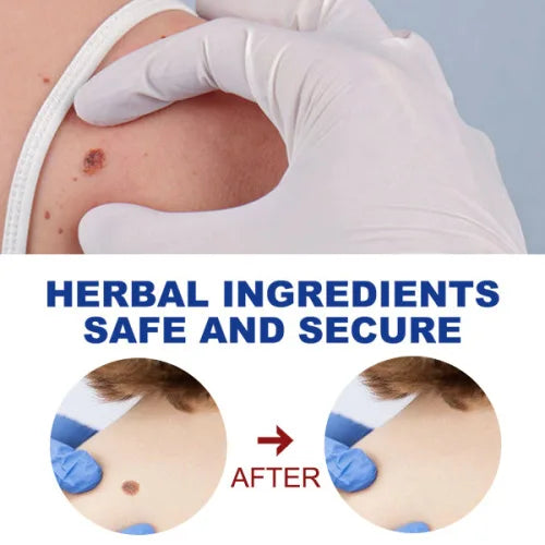 EELHOE Pen Gently Cleanses Skin Care Body Face Label Meat Pellet Kayu Liquid