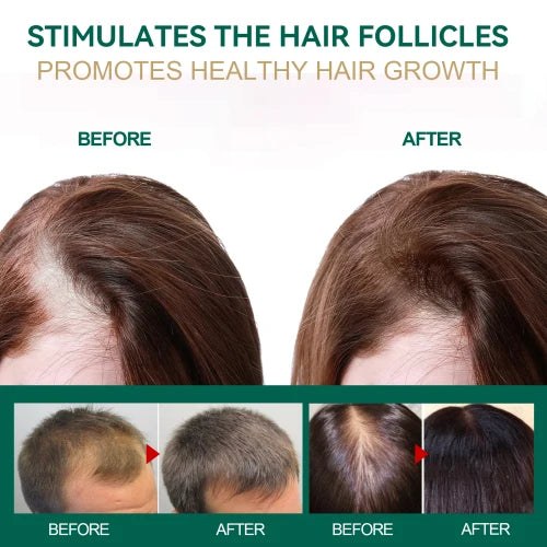 Jaysuing Ginger Dense Essential Oil Cream Prevent Loss Repair Hair Roots Improve Dry Frizz  Nourish And