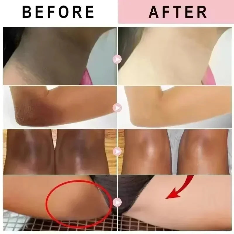 Remove Melanin Nicotinamide Brightening Cream For Dark Skin Effective Lighten Thigh Inner Bleach Private Parts Brighten Cream