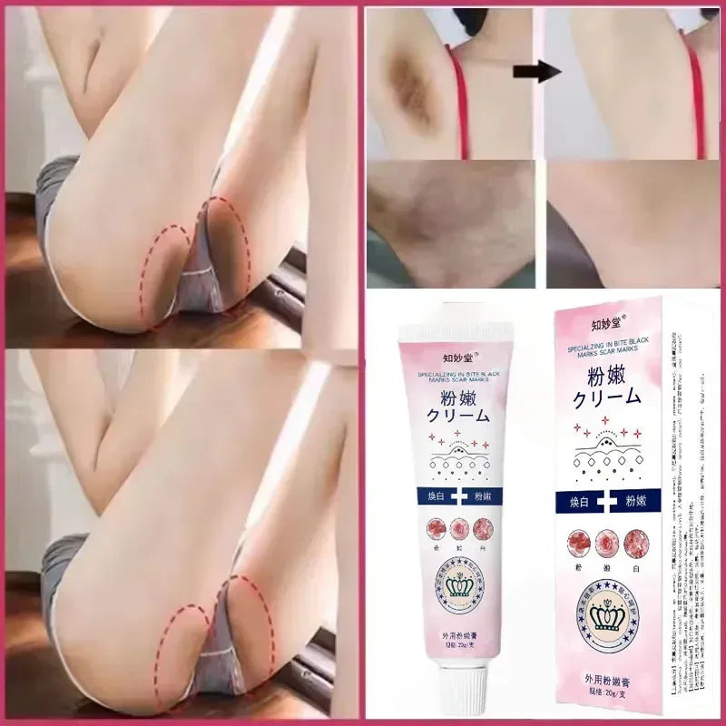Remove Melanin Nicotinamide Brightening Cream For Dark Skin Effective Lighten Thigh Inner Bleach Private Parts Brighten Cream