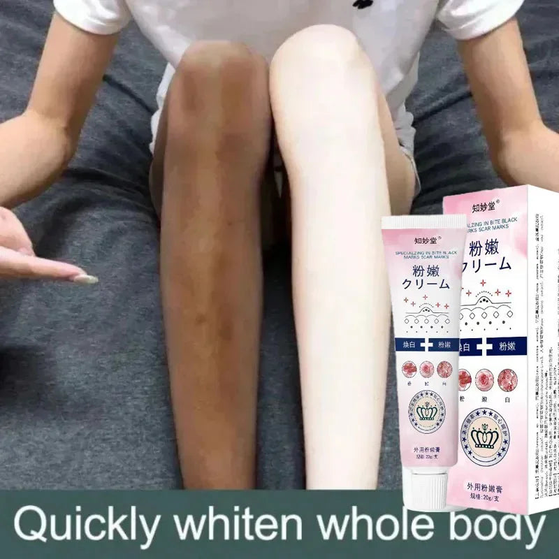 Remove Melanin Nicotinamide Brightening Cream For Dark Skin Effective Lighten Thigh Inner Bleach Private Parts Brighten Cream